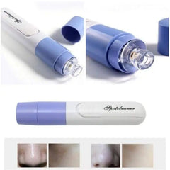 Electric Blackhead Remover Vacuum – Pore Cleaner & Acne Extraction Device (Random Color)